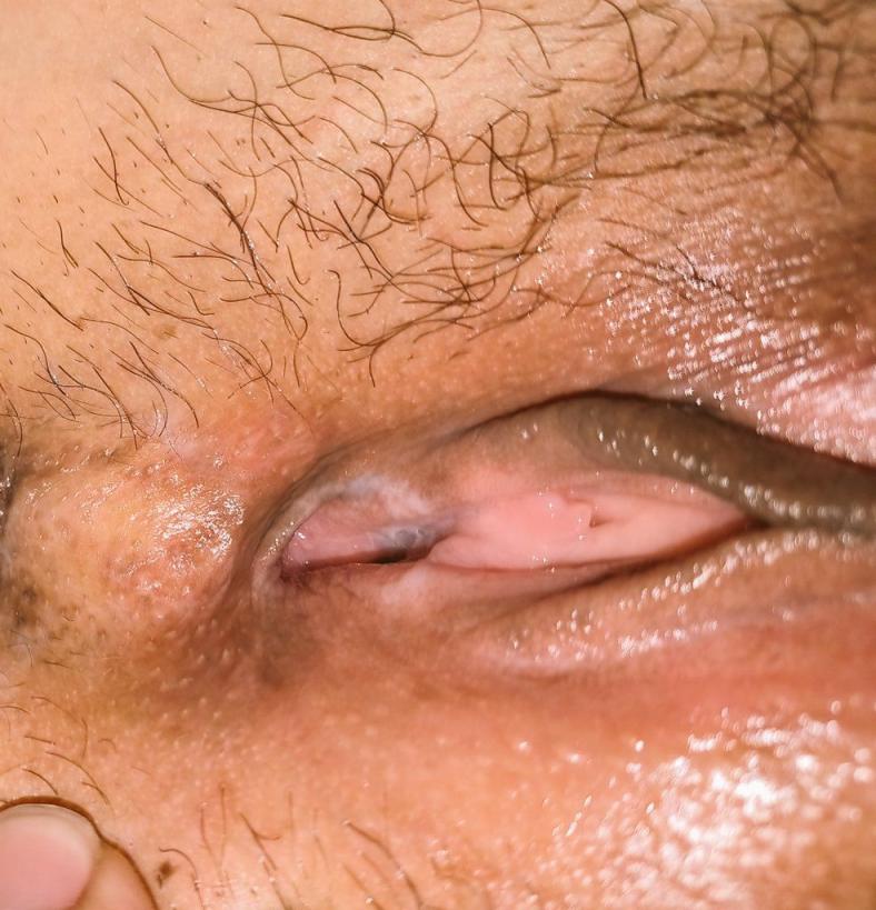 有毛跟无毛逼[46P]