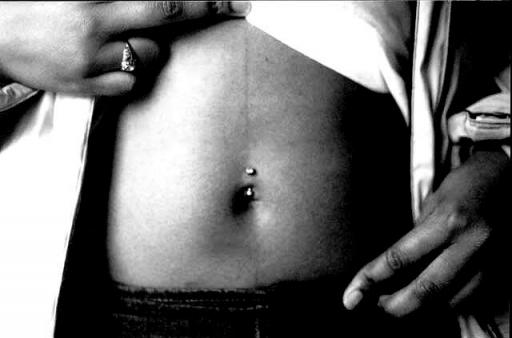 脐钉